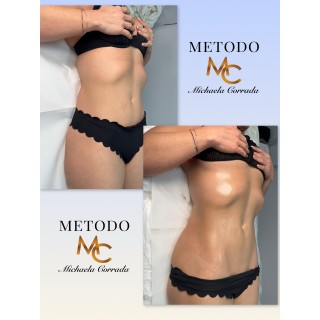 Una seduta di  Linfodrenaggio MC 💎