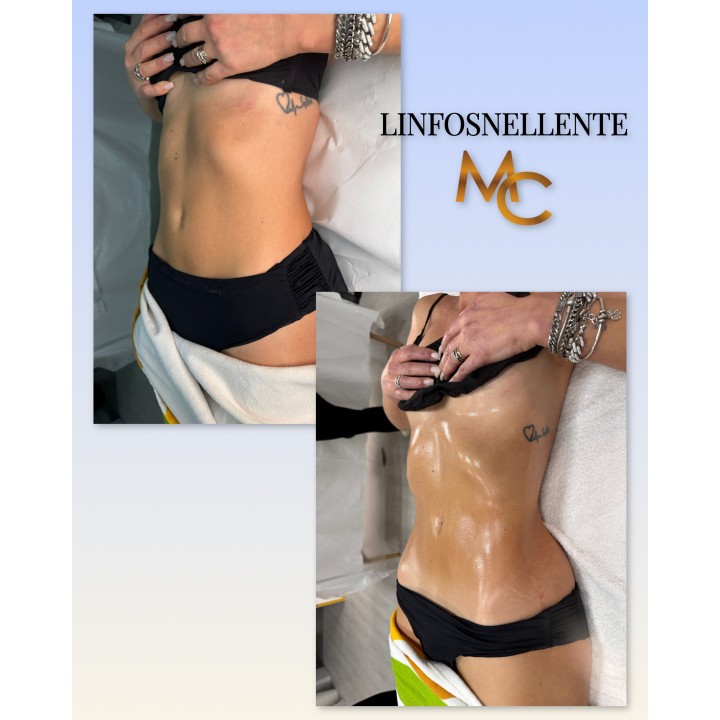 Una seduta di  Linfodrenaggio MC 💎